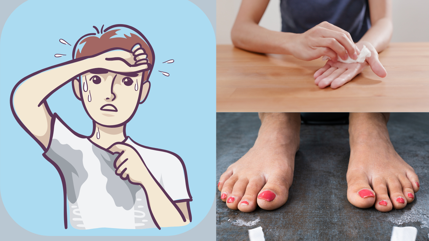 Excessive Sweating-Hyperhidrosis