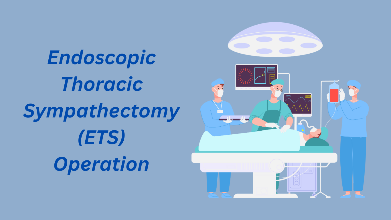 Endoscopic Thoracic Sympathectomy